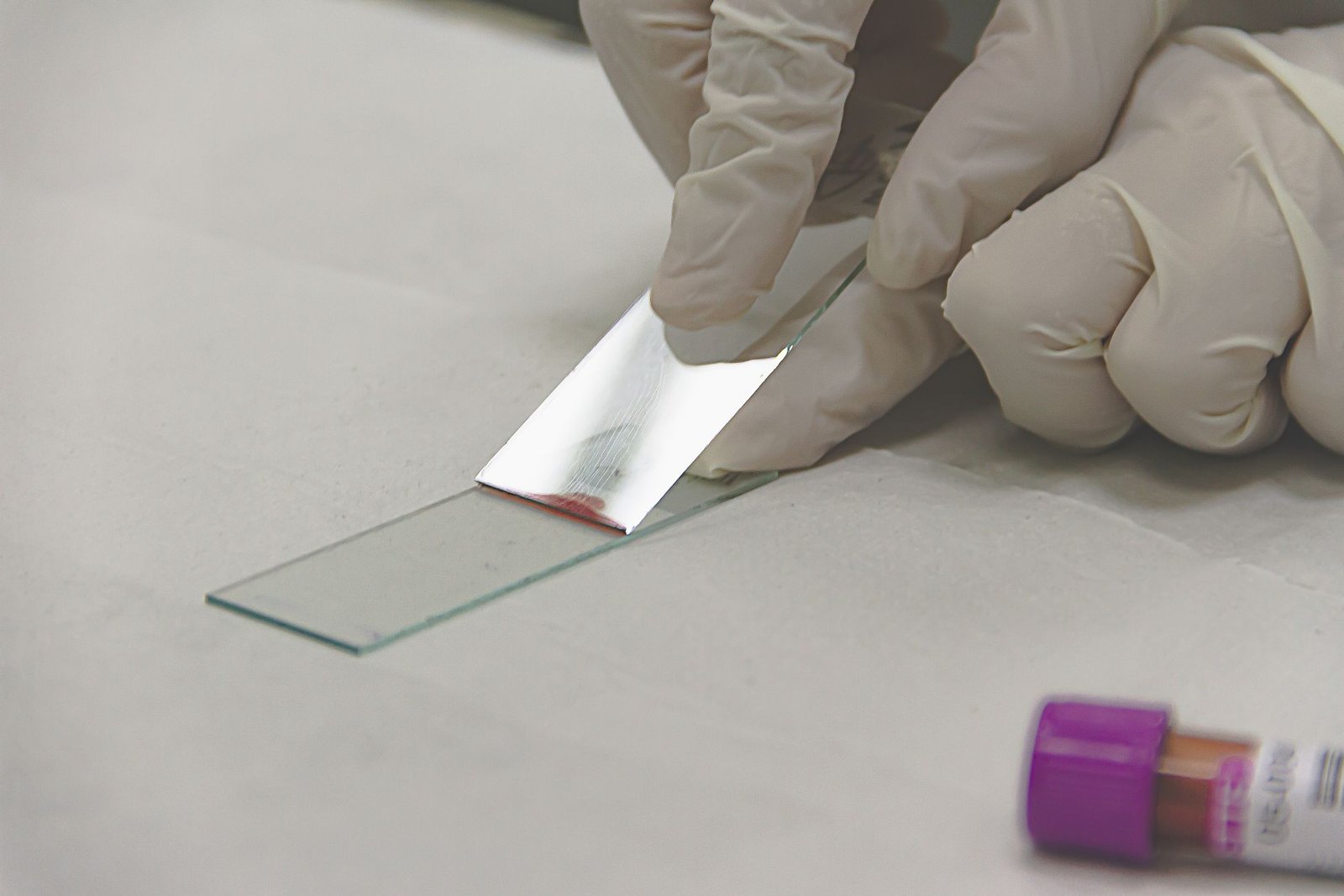 Blood Film for Malaria Parasites care photograph