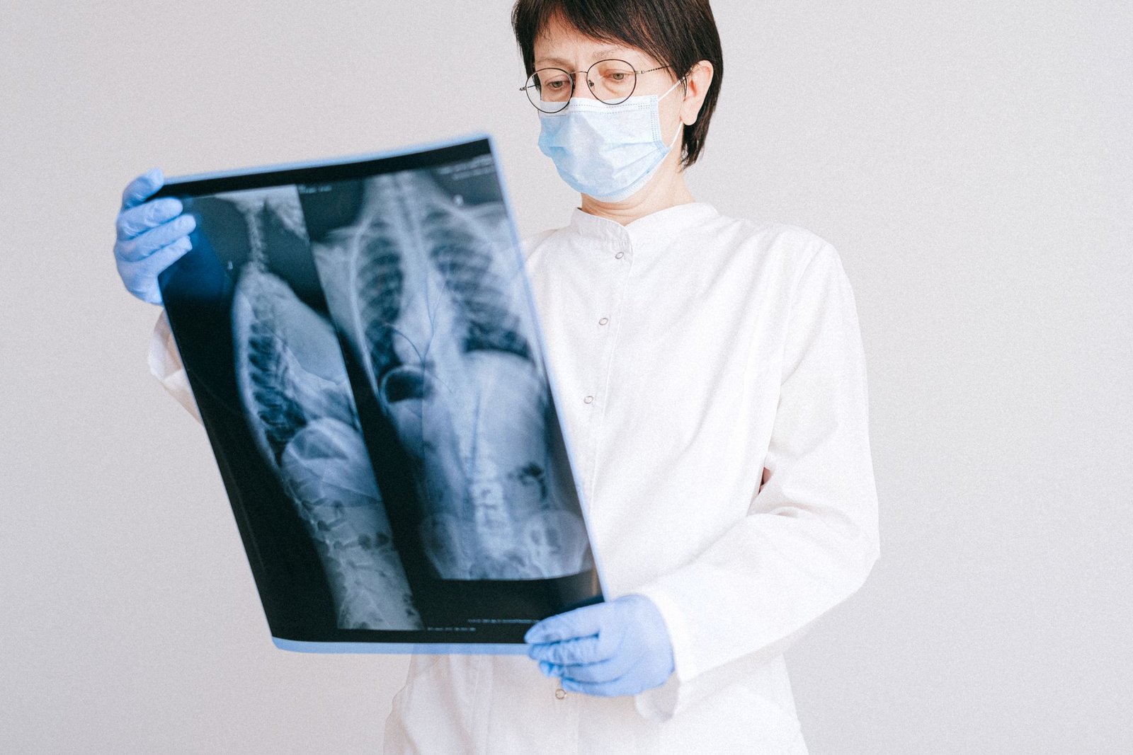 Thoracic X-ray: Thoracic Inlet care photograph