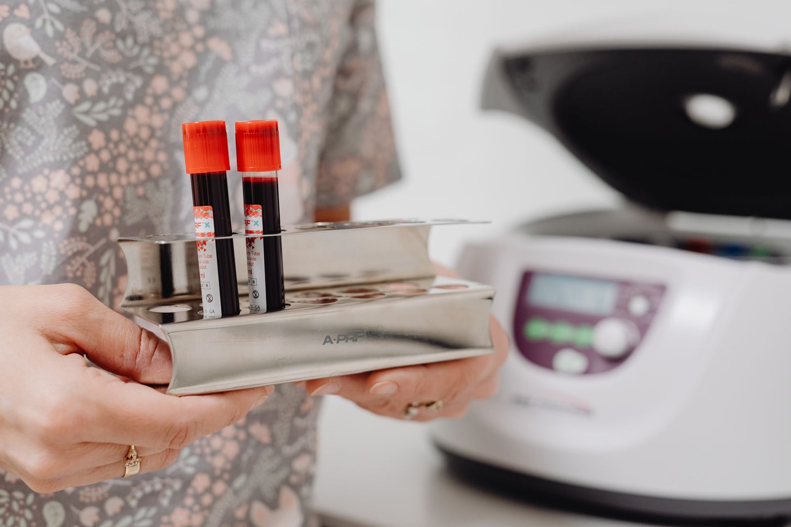 Liver Function Test care photograph
