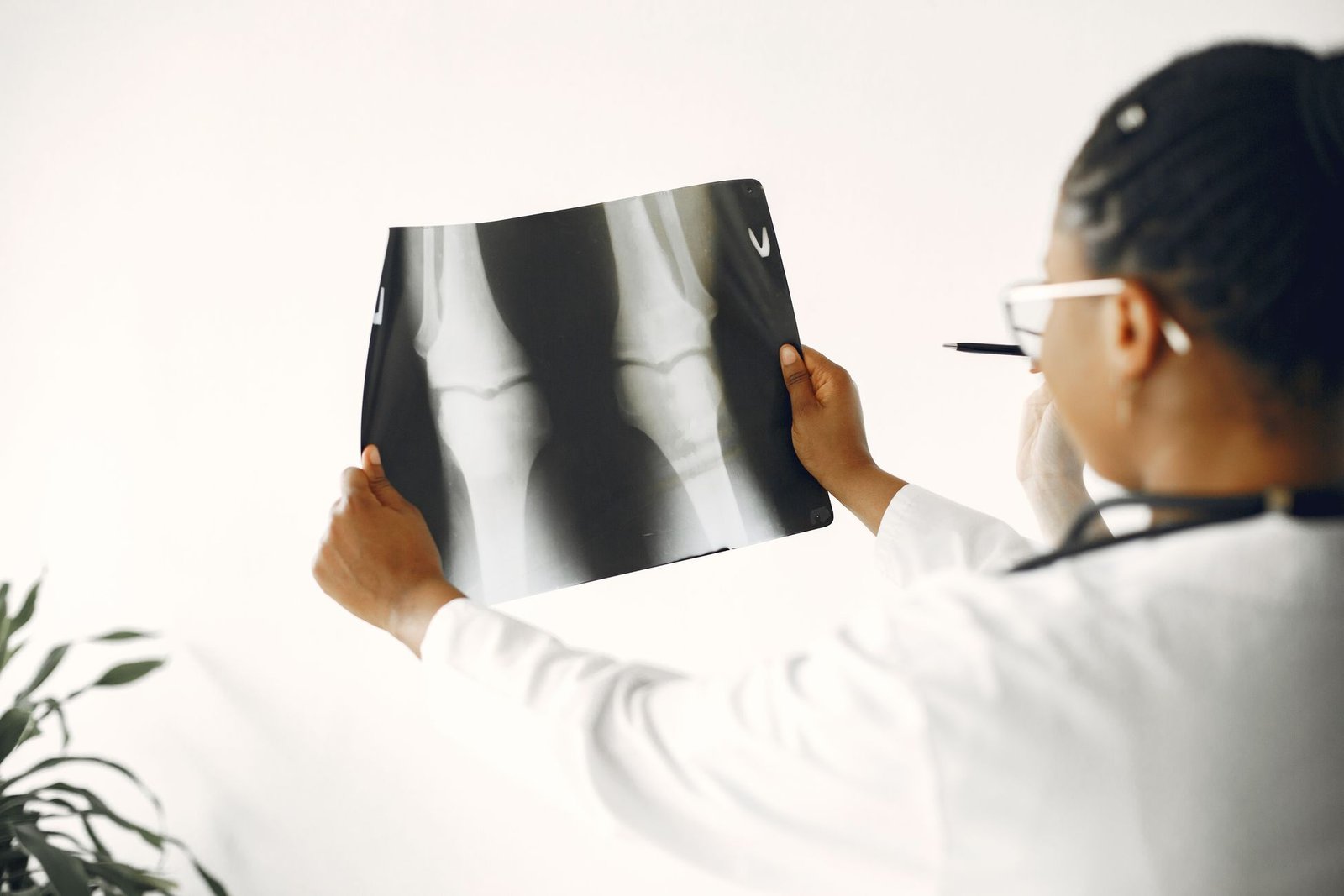 Upper limb X-ray: Humerus care photograph