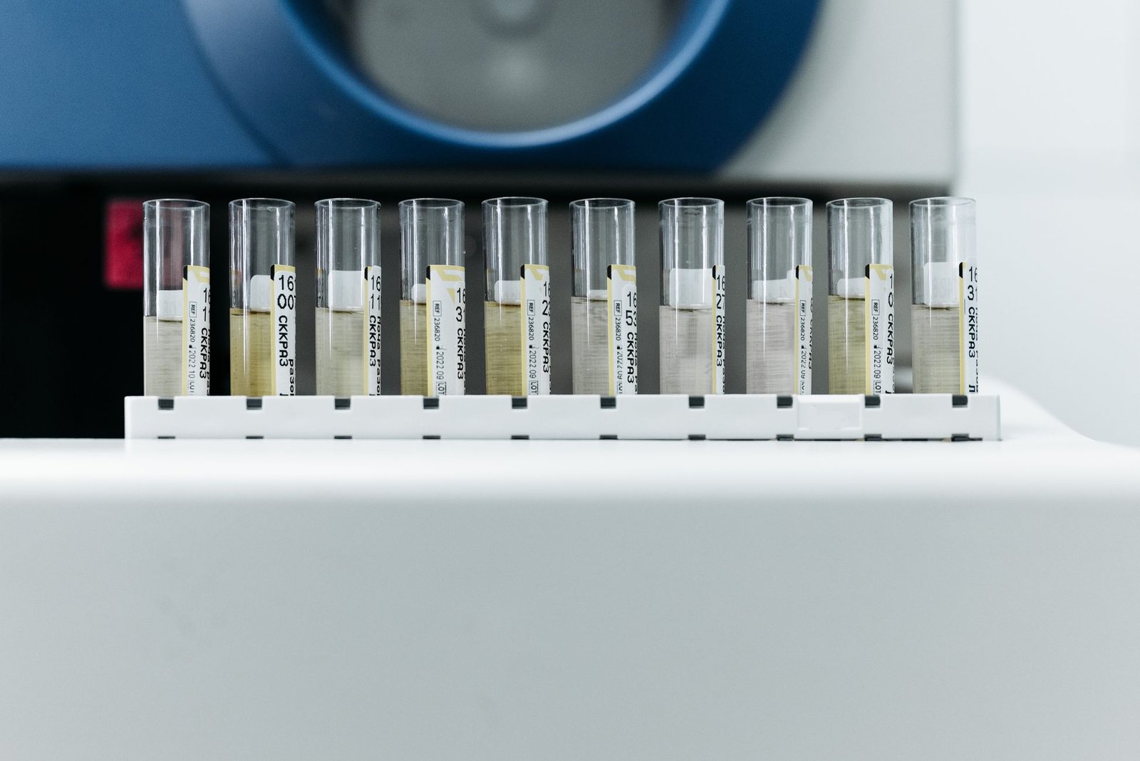 Sputum Microscopy, Culture & Sensitivity care photograph