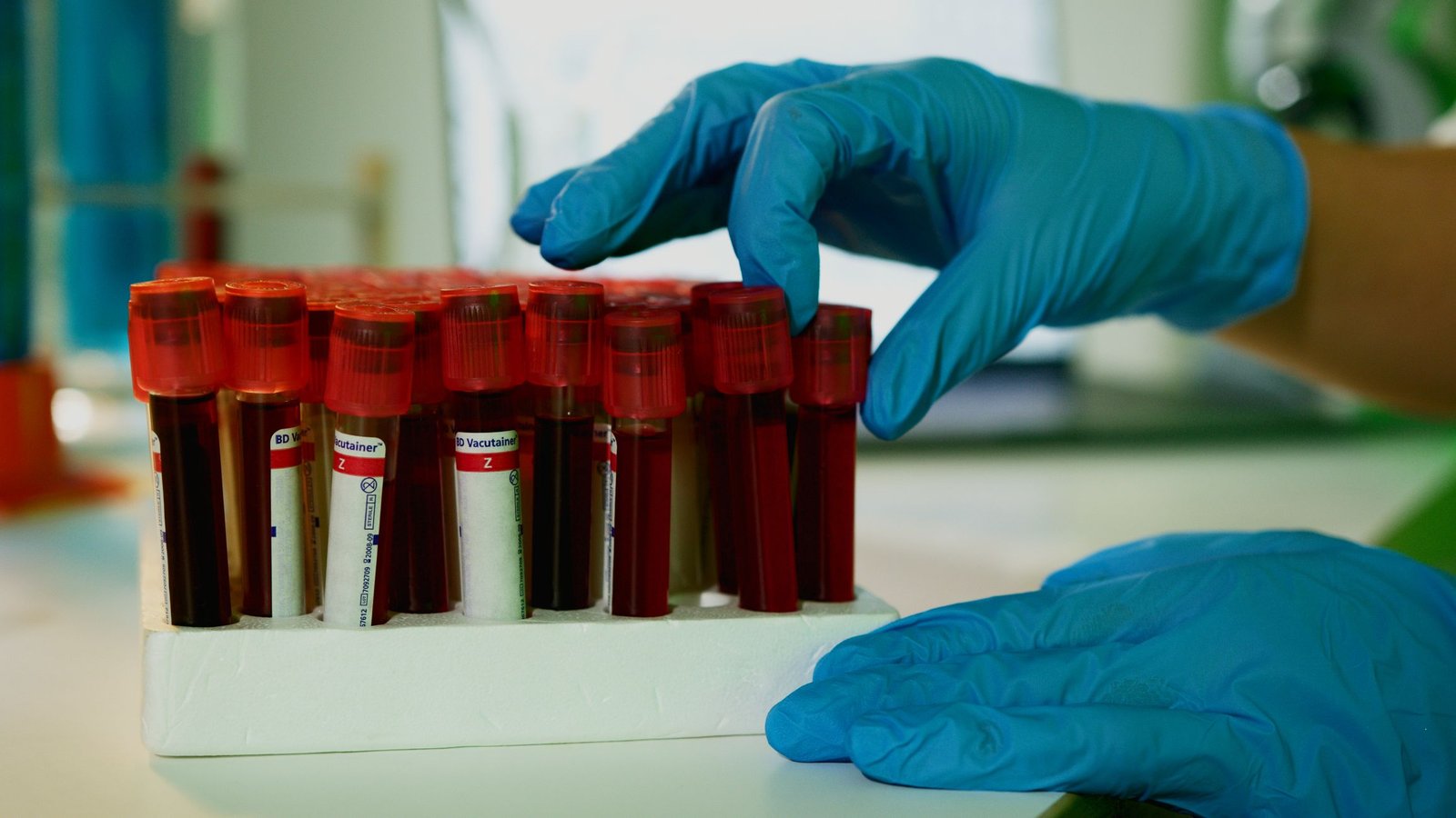 White Cell Count (WBC) care photograph