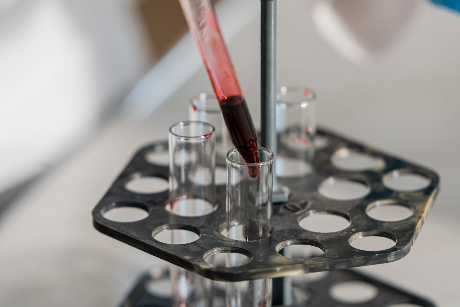 Red Cell Count (RBC) care photograph